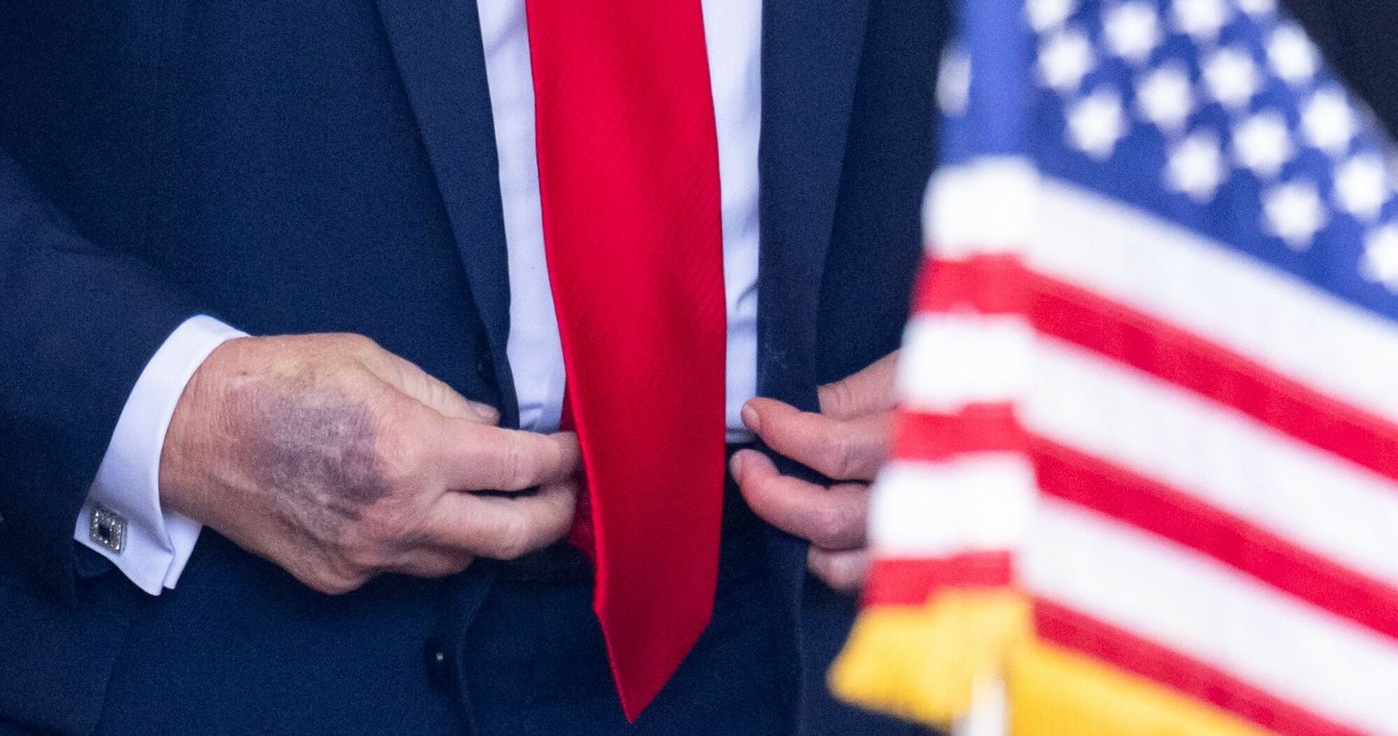 Trump przeszedł badania. Co ze zdrowiem amerykańskiego prezydenta?