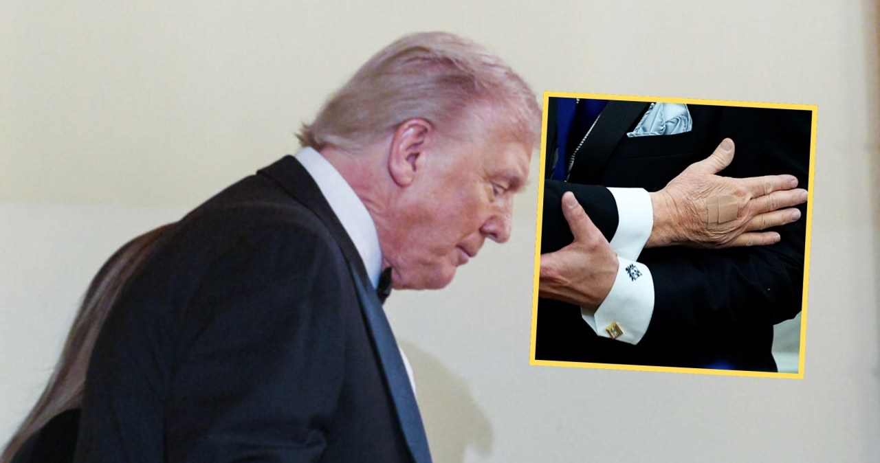 Plastry na dłoni Donalda Trumpa wywołały lawinę pytań. Rzeczniczka tłumaczy
