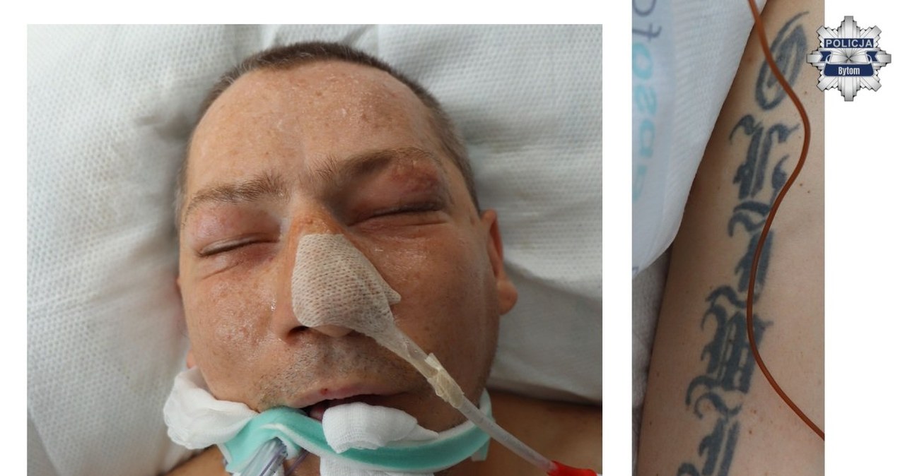 Rozpoznajesz tego mężczyznę? Pilny apel policji