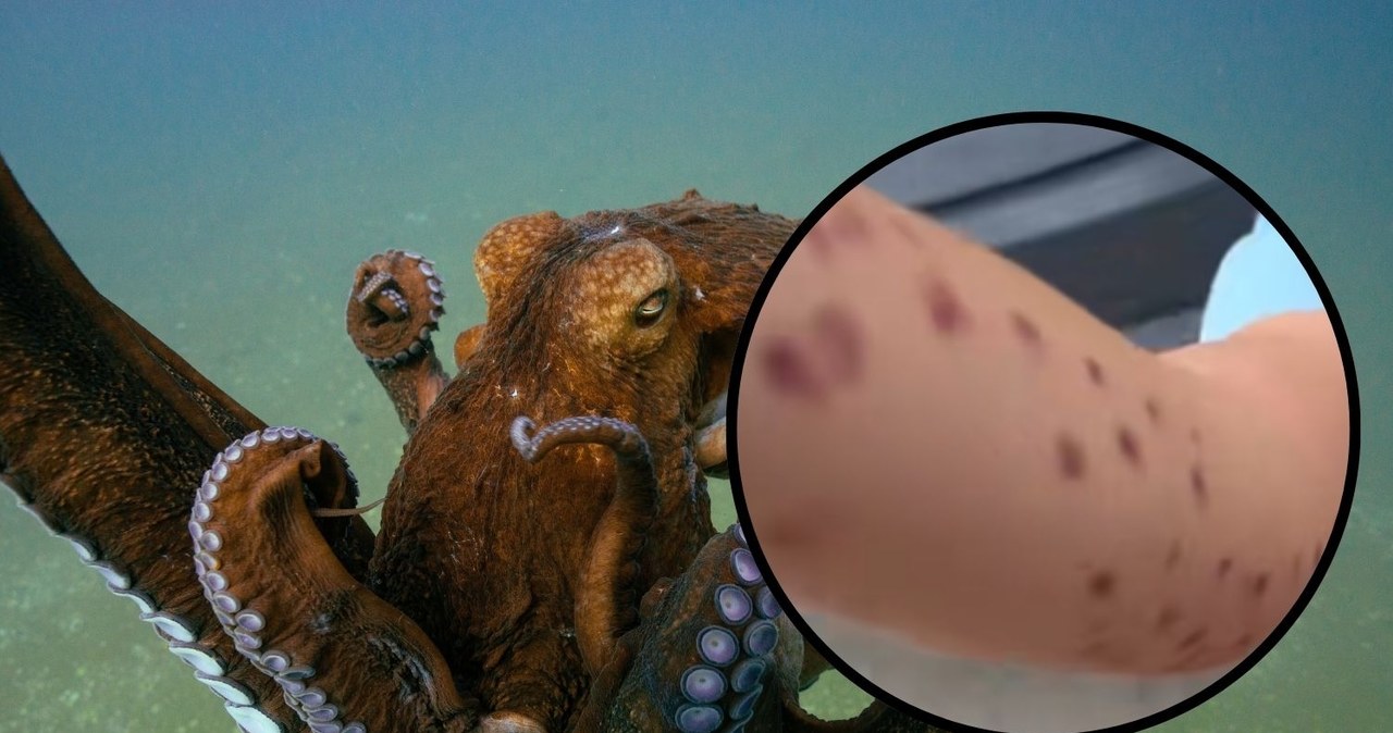 Szokujące sceny w oceanarium. Ośmiornica zaatakowała 6-latka?