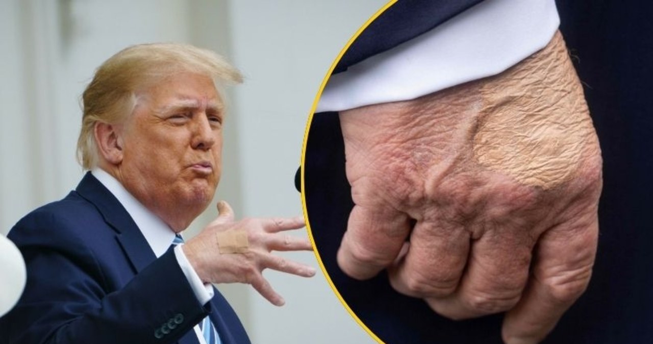 Biały Dom o stanie zdrowia Trumpa. Wątpliwości rozwiane?