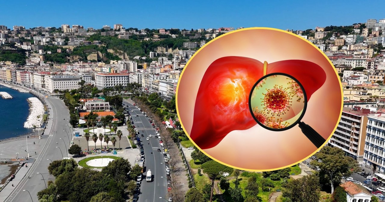 Epidemia WZW A we włoskim kurorcie. Zakażenie po zjedzeniu określonego produktu