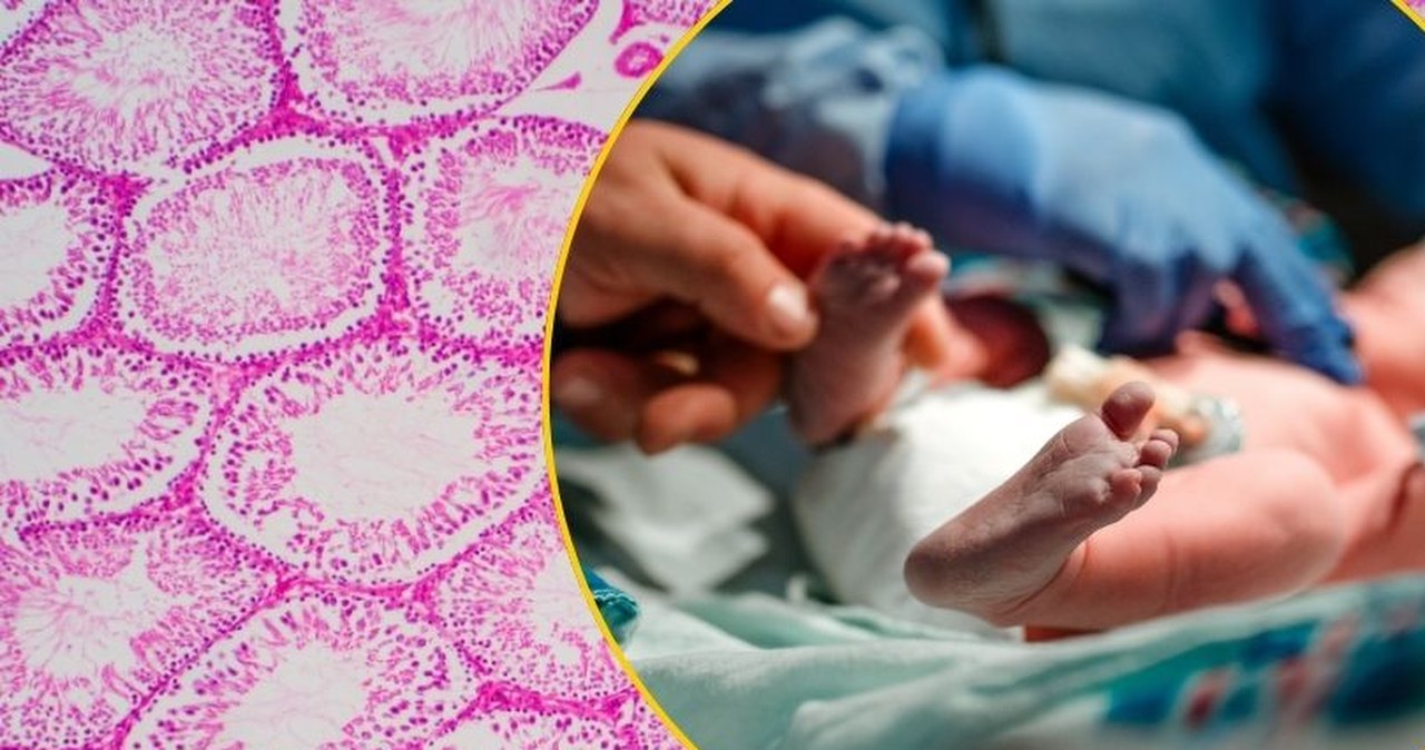 Genetyczna pułapka w banku spermy. Blisko 200 dzieci w Europie zagrożone rakiem