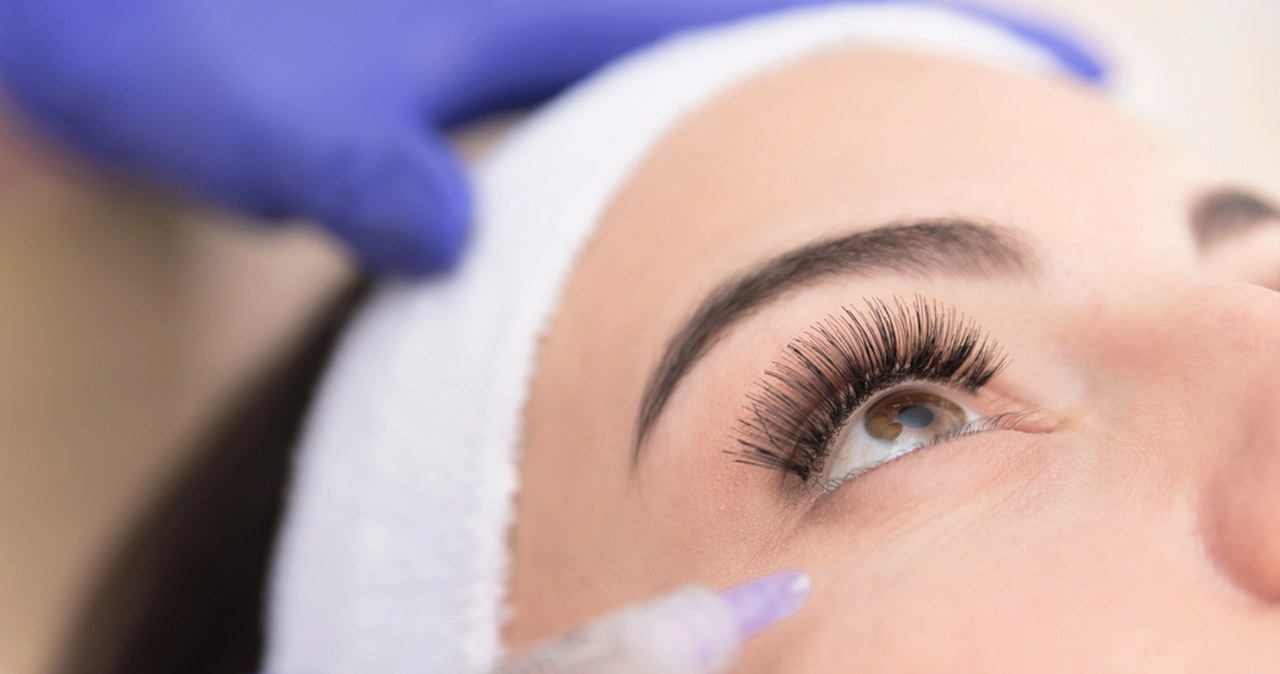 Mezoterapia igłowa pod oczy: Skuteczna walka z cieniami i wiotkością skóry