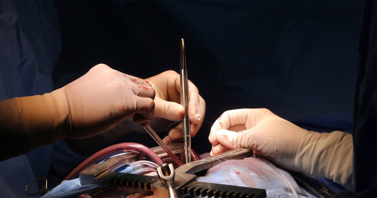 Dwa zabiegi naraz, by uniknąć nowego udaru. Śląski szpital z wyjątkową procedurą
