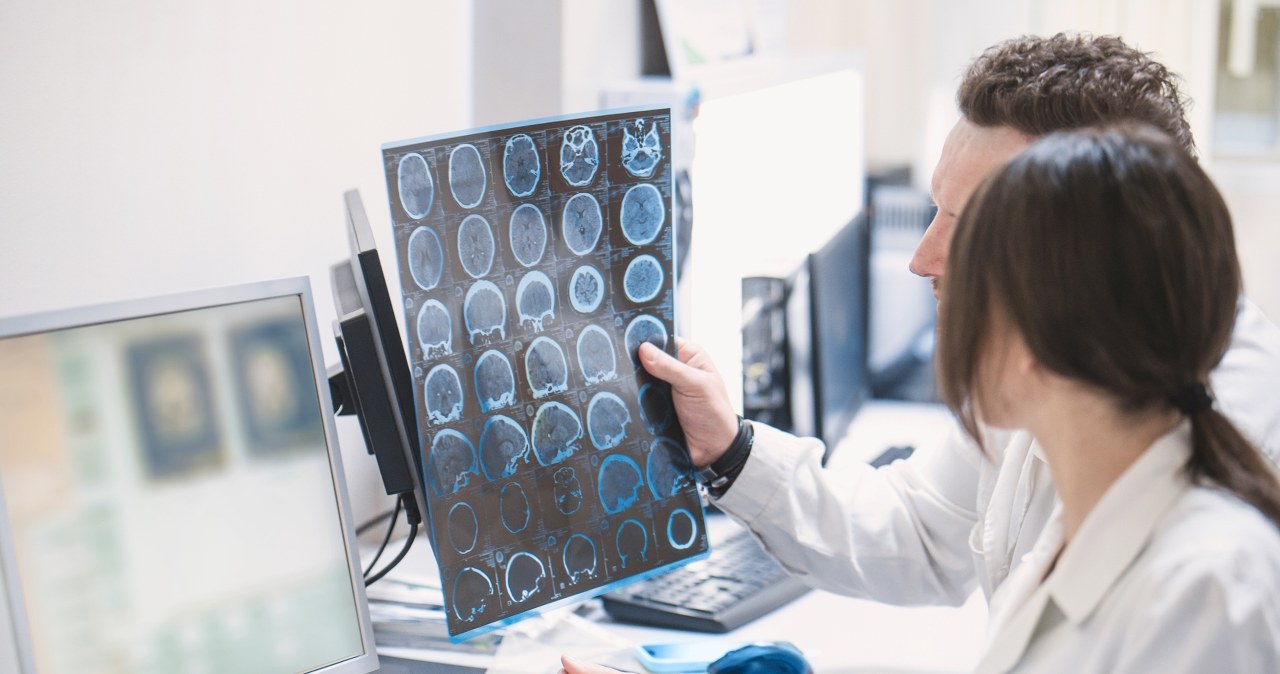 Menopauza a choroba Alzheimera. Najnowsze badania dają do myślenia