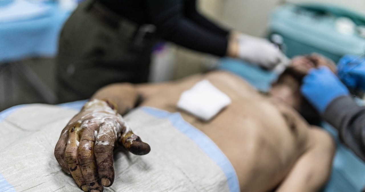 Ranny Ukrainiec czekał 33 dni. Wysłali po niego robota