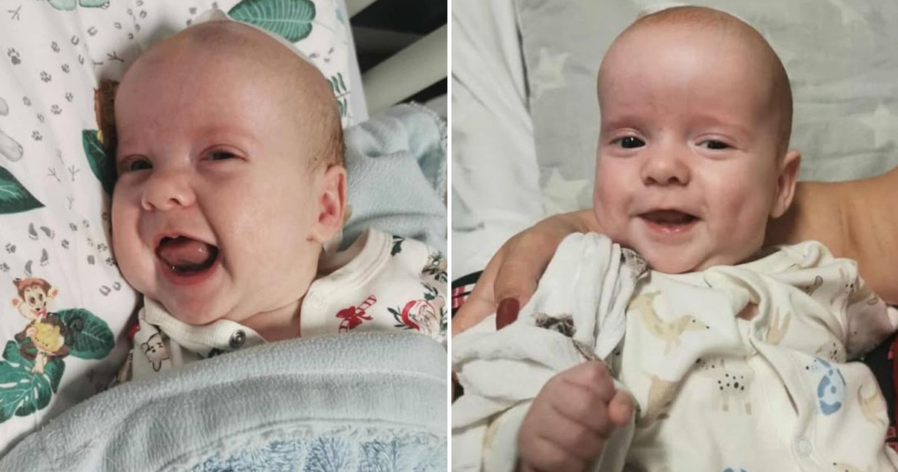 Pierwszy taki zabieg u bliźniąt. Poruszające podziękowania rodziców