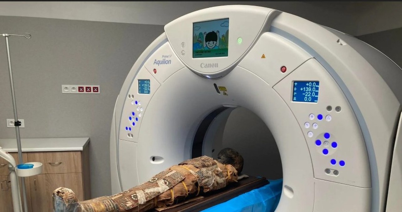 Co ukrywa mumia chłopca z Wrocławia? Zaskakujące odkrycie pod bandażami