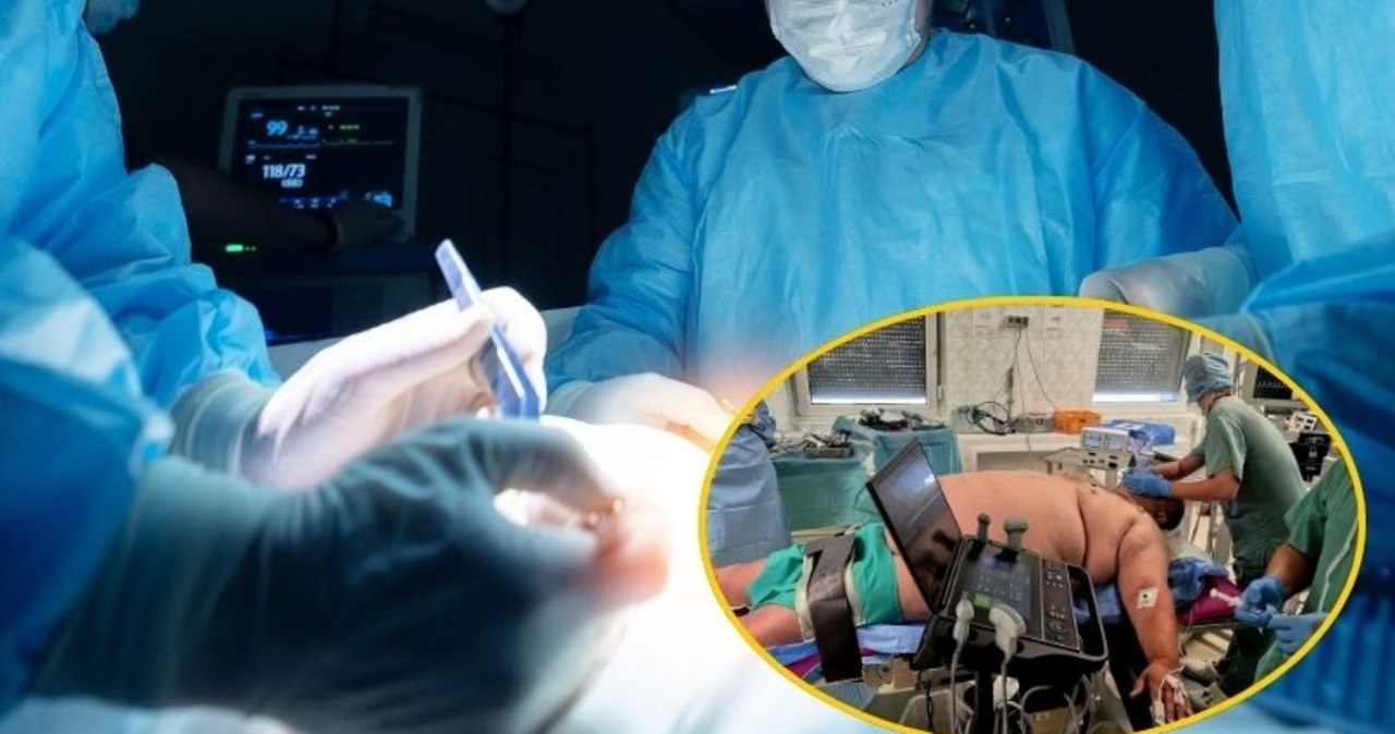 ​Pacjent ważył ćwierć tony, wszystkie metody walki z otyłością zawiodły